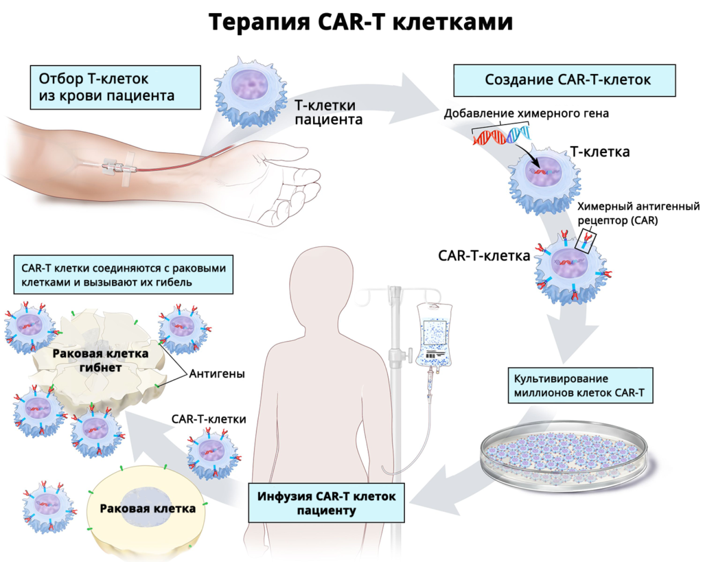 терапия CAR-T клетками