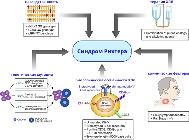 Причины возникновения синдрома Рихтера при ХЛЛ